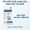 gel devenil xóa nốt ruồi mụn thịt